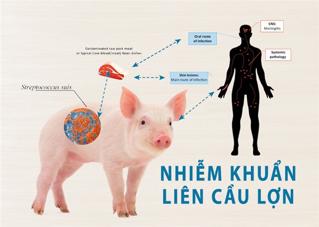 Quảng Ninh ghi nhận ca nhiễm liên cầu khuẩn lợn tại phường Việt Hưng